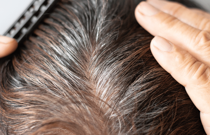 Padra Medical Center hair transplant
