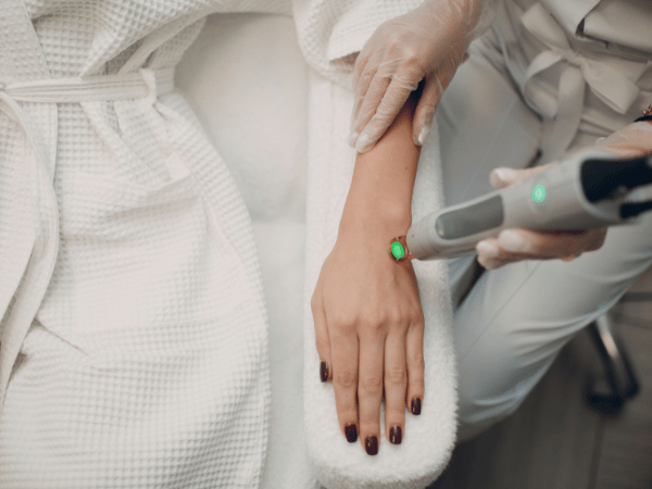 Laser hair removal