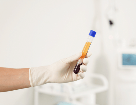 prp hair treatment in dubai